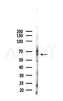 PODN Antibody - Western blot analysis of lysates from HepG2 cells(heat-shock,45min treatment), using PODN Antibody at 1/1000 dilution.