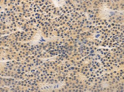 OPTC Antibody - DF10169 at 1/100 staining human pituitary adenoma by IHC-P.