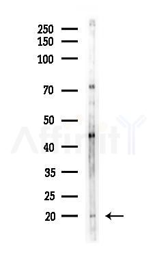 TXN2 Antibody - Western blot analysis of lysates from HUVEC cells(LPS, 4h treatment), using TXN2 Antibody at 1/1000 dilution.