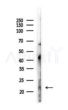 TNFRSF17 Antibody - Western blot analysis of lysates from COLO205 cells(LPS, 4h treatment), using TNFRSF17 Antibody at 1/1000 dilution.