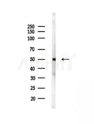 CCR8 Antibody - Western blot analysis of lysates from PC12 cells(UV,30min treatment), using CCR8 Antibody at 1/1000 dilution.