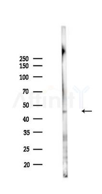 GPR182 Antibody - Western blot analysis of lysates from PC12 cells(UV,30min treatment), using GPR182 Antibody at 1/1000 dilution.