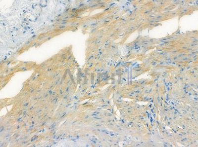 OR10P1 Antibody - DF10235 at 1/100 staining human normal colon tissue by IHC-P.