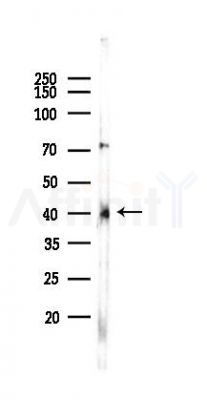 OR1A2 Antibody - Western blot analysis of lysates from 293 cells(UV,30min treatment), using OR1A2 Antibody at 1/1000 dilution.