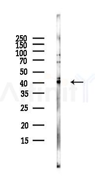 P2RY9 Antibody - Western blot analysis of lysates from EC304 cells(LPS, 4h treatment), using P2RY9 Antibody at 1/1000 dilution.