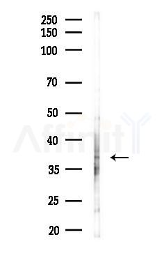 P2RY12 Antibody - Western blot analysis of lysates from HUVEC cells(LPS, 4h treatment), using P2RY12 Antibody at 1/1000 dilution.