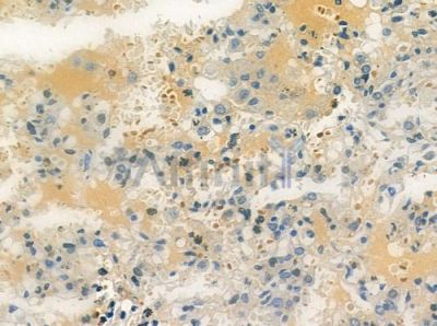 TAAR6 Antibody - DF10276 at 1/100 staining human normal lung tissue by IHC-P.