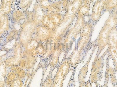 VN1R1 Antibody - DF10280 at 1/100 staining human normal kidney tissue by IHC-P.