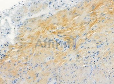 OR52N2 Antibody - DF10288 at 1/100 staining human normal colon tissue by IHC-P.