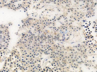 OR52P1 Antibody - DF10290 at 1/100 staining human pituitary adenoma by IHC-P.