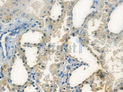 OR5M1 Antibody - DF10298 at 1/100 staining human normal kidney tissue by IHC-P.