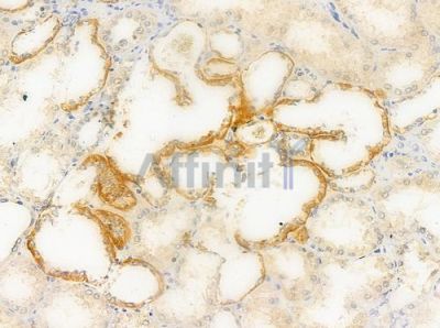 HCG39951 Antibody - DF10306 at 1/100 staining human normal kidney tissue by IHC-P.