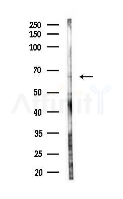 BMAL1 Antibody - Western blot analysis of lysates from HUVEC cells(LPS, 4h treatment), using BMAL1 Antibody at 1/1000 dilution.