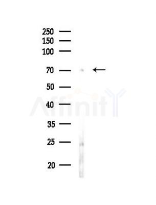 Kv3.4/KCNC4 Antibody - Western blot analysis of lysates from RAW264.