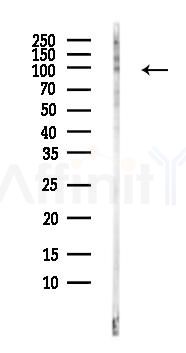 TRPV1 Antibody - Western blot analysis of lysates from HepG2 cells(LPS, 4h treatment), using TRPV1 Antibody at 1/1000 dilution.