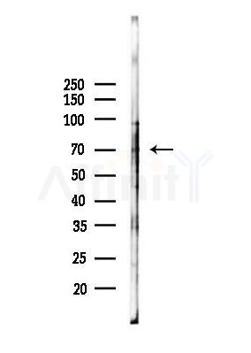 DYRK1A/B Antibody - Western blot analysis of lysates from B16F10-LUC cells(heat-shock,45min treatment), using DYRK1A/B Antibody at 1/1000 dilution.
