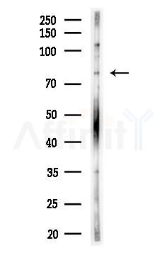 eIF2B epsilon Antibody - Western blot analysis of lysates from HUVEC cells(LPS, 4h treatment), using eIF2B epsilon Antibody at 1/1000 dilution.