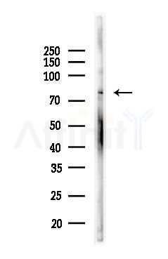 eIF2B epsilon Antibody - Western blot analysis of lysates from COLO205 cells(LPS, 4h treatment), using eIF2B epsilon Antibody at 1/1000 dilution.