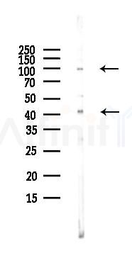 DAG1 Antibody - Western blot analysis of lysates from EC304 cells(LPS, 4h treatment), using DAG1 Antibody at 1/1000 dilution.