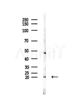 IFT20 Antibody - Western blot analysis of lysates from Mouse lung, using IFT20 Antibody at 1/1000 dilution.