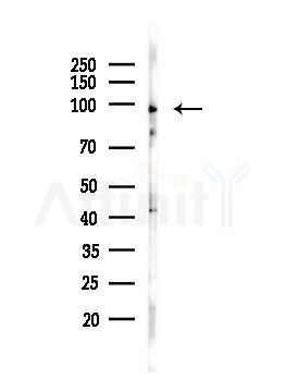 METTL3 Antibody - Western blot analysis of lysates from A375 cells(heat-shock,45min treatment), using METTL3 Antibody at 1/1000 dilution.