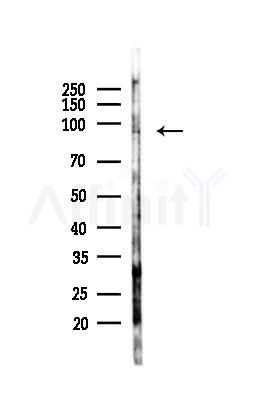 METTL3 Antibody - Western blot analysis of lysates from LoVo cells(heat-shock,45min treatment), using METTL3 Antibody at 1/1000 dilution.