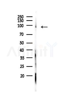 METTL3 Antibody - Western blot analysis of lysates from PC12 cells, using METTL3 Antibody at 1/1000 dilution.