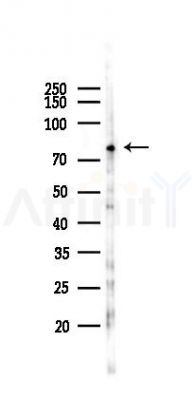 PLOD3 Antibody - Western blot analysis of lysates from 293 cells(UV,30min treatment), using PLOD3 Antibody at 1/1000 dilution.