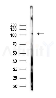 MKS3 Antibody - Western blot analysis of lysates from B16F10-LUC cells(uv30min treatment), using MKS3 Antibody at 1/1000 dilution.