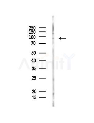SEC5/EXOC2 Antibody - Western blot analysis of lysates from PC12 cells, using SEC5/EXOC2 Antibody at 1/1000 dilution.