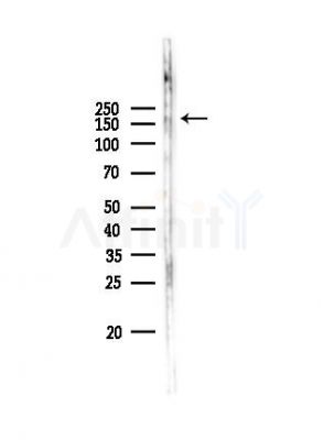 KIAA1199 Antibody - Western blot analysis of lysates from Mouse brain, using KIAA1199 Antibody at 1/1000 dilution.