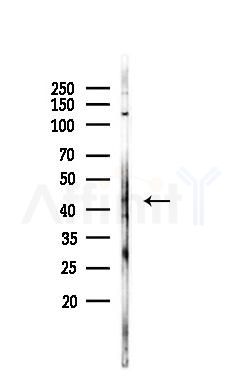 ABHD5 Antibody - Western blot analysis of lysates from A375 cells(heat-shock,45min treatment), using ABHD5 Antibody at 1/1000 dilution.