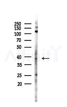 ABHD5 Antibody - Western blot analysis of lysates from LoVo cells(heat-shock,45min treatment), using ABHD5 Antibody at 1/1000 dilution.