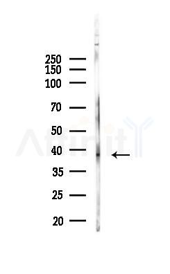 ABHD5 Antibody - Western blot analysis of lysates from PC12 cells, using ABHD5 Antibody at 1/1000 dilution.