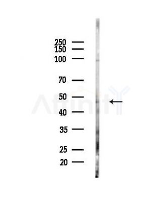 GDI2 Antibody - Western blot analysis of lysates from PC12 cells(LPS,4h treatment), using GDI2 Antibody at 1/1000 dilution.