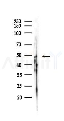 GDI2 Antibody - Western blot analysis of lysates from HUVEC cells(starvation,24h treatment), using GDI2 Antibody at 1/1000 dilution.