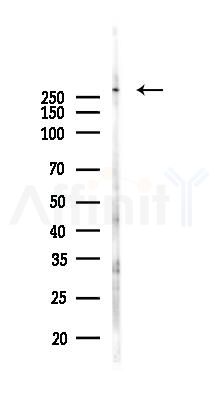 Piezo1 Antibody - Western blot analysis of lysates from Hela cells(LPS, 4h treatment), using Piezo1 Antibody at 1/1000 dilution.
