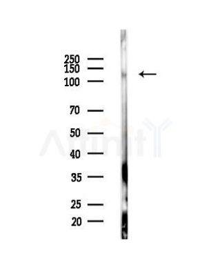 TET2 Antibody - Western blot analysis of lysates from MDA-MB-231 cells(heat-shock,45min treatment), using TET2 Antibody at 1/1000 dilution.