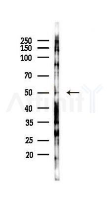 DEK Antibody - Western blot analysis of lysates from LoVo cells(heat-shock,45min treatment), using DEK Antibody at 1/1000 dilution.