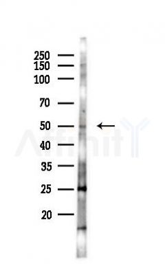 DEK Antibody - Western blot analysis of lysates from PC12 cells, using DEK Antibody at 1/1000 dilution.