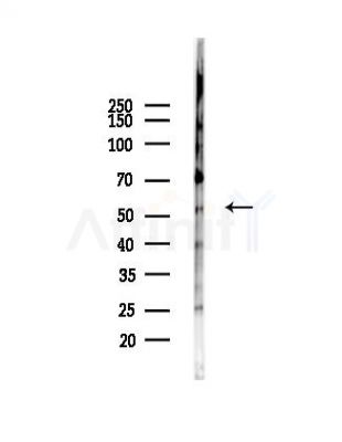 KMO Antibody - Western blot analysis of lysates from Hela cells(UV,30min treatment), using KMO Antibody at 1/1000 dilution.