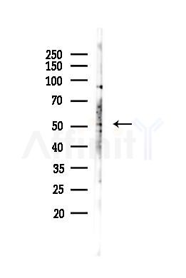 NR1H2 Antibody - Western blot analysis of lysates from A375 cells(heat-shock,45min treatment), using NR1H2 Antibody at 1/1000 dilution.