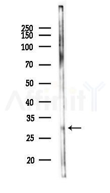 RAB3D Antibody - Western blot analysis of lysates from Mouse liver, using RAB3D Antibody at 1/1000 dilution.