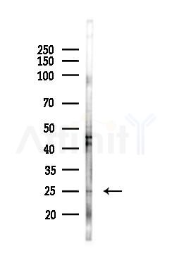 Cyclophilin B Antibody - Western blot analysis of lysates from A375 cells(heat-shock,45min treatment), using Cyclophilin B Antibody at 1/1000 dilution.