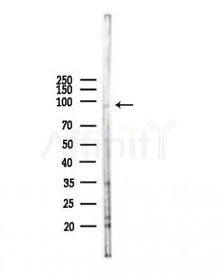 ELAC2 Antibody - Western blot analysis of lysates from B16F10-LUC cells(heat-shock,45min treatment), using ELAC2 Antibody at 1/1000 dilution.