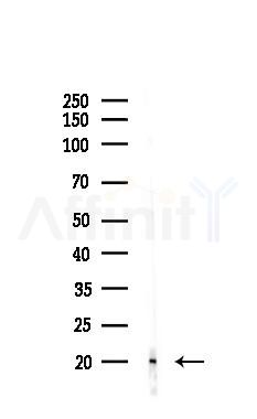 ISCU Antibody - Western blot analysis of lysates from K562 cells(70℃变性,uv30min treatment), using ISCU Antibody at 1/1000 dilution.