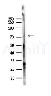 VPS33B Antibody - Western blot analysis of lysates from HUVEC cells(starvation,24h treatment), using VPS33B Antibody at 1/1000 dilution.