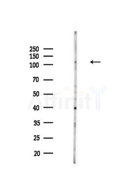 EXOC1 Antibody - Western blot analysis of lysates from MDA-MB-231 cells(heat-shock,45min treatment), using EXOC1 Antibody at 1/1000 dilution.