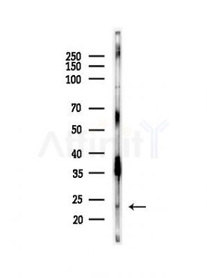 ICT1 Antibody - Western blot analysis of lysates from HepG2 cells(starvation,24h treatment), using ICT1 Antibody at 1/1000 dilution.
