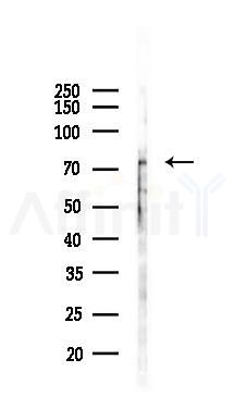 MTO1 Antibody - Western blot analysis of lysates from B16F10-LUC cells(uv30min treatment), using MTO1 Antibody at 1/1000 dilution.